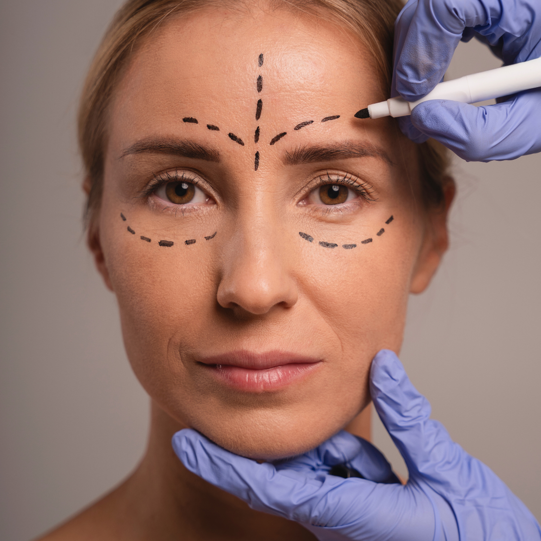 Face Lift Treatment